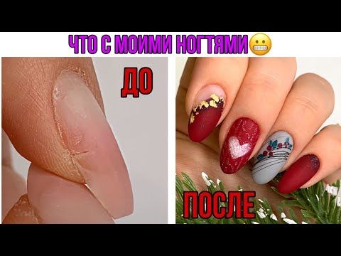 Сломала ноготь 😐 Ноготь висит на ...