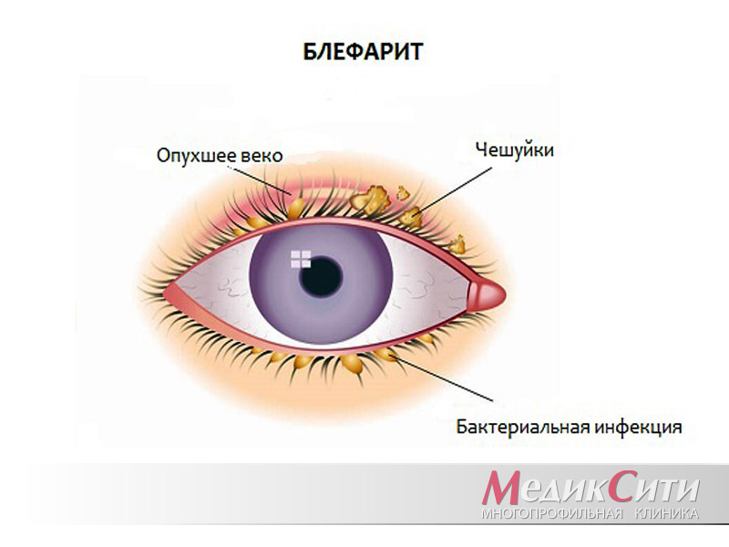 Эксперты по красоте объясняют, почему лечение ресниц, любимое ...