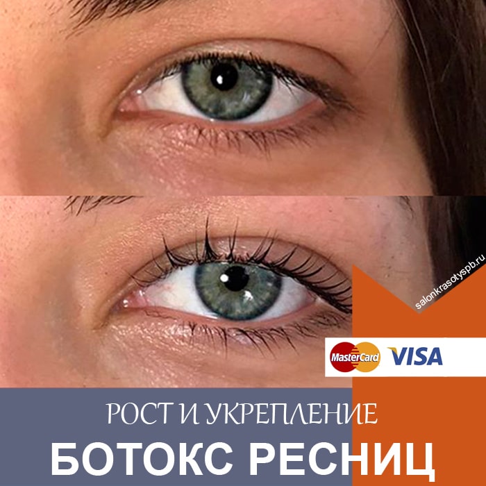 Vitamin Lash Botox от My Lamination (15 ...