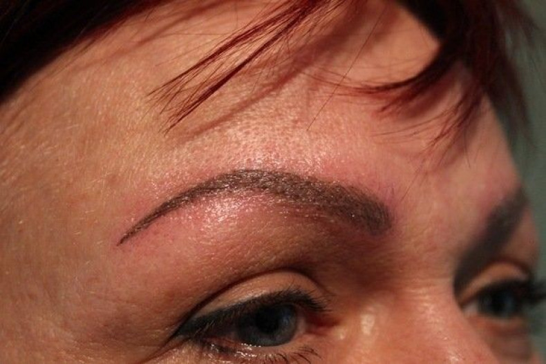 Brow Tattooing — The Cosmetic Tattoo ...