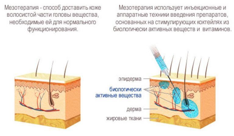 Поредение волос - Cosmedica Clinic - Dr. Levent Acar