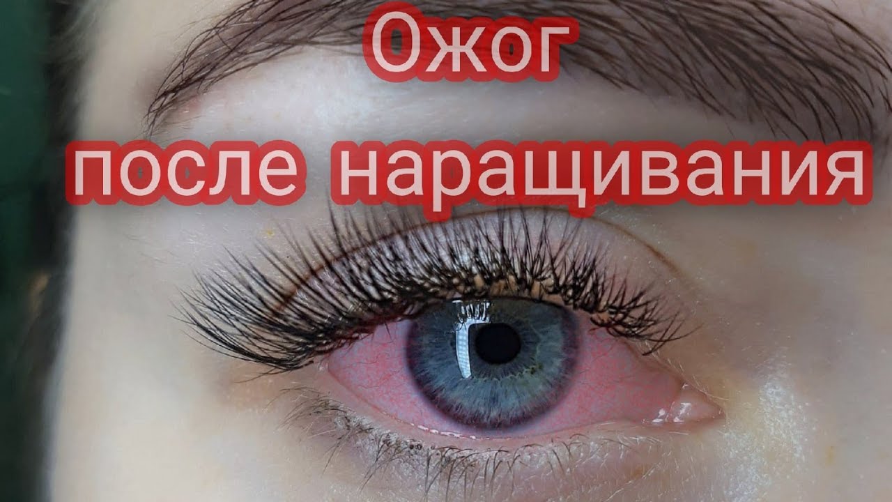 Lion_lashes - НАРАСТИЛА РЕСНИЦЫ , а глаза болят и чешутся ...