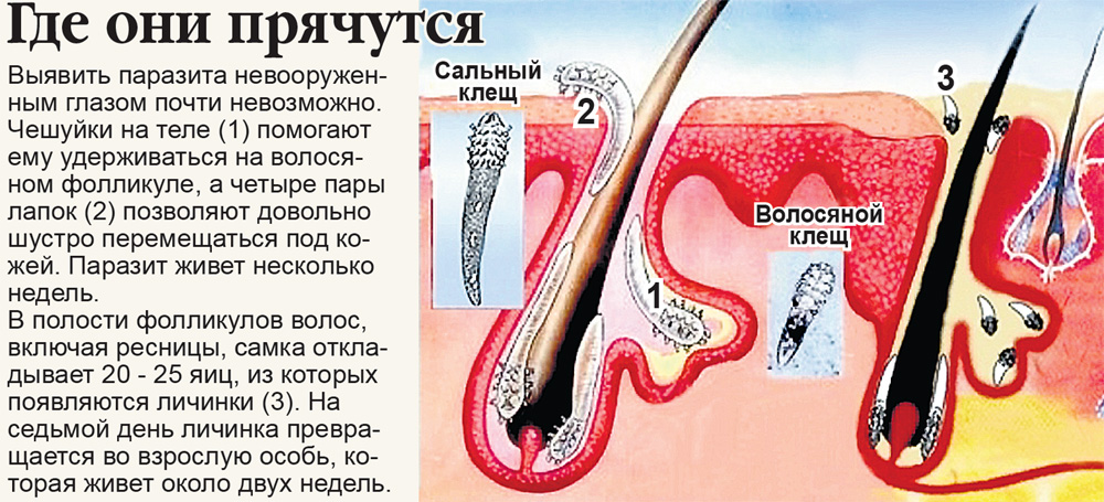 Клещ демодекс - причина демодекоза