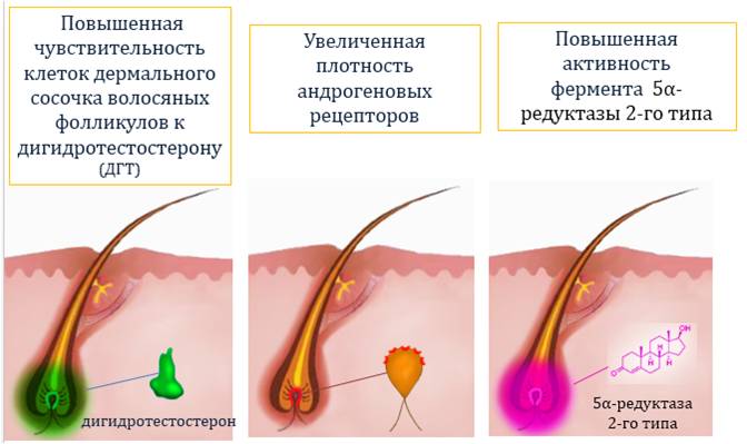 Облысение. Выпадение волос. Поделитесь у кого был опыт в ...