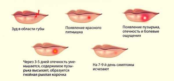 Перманентный макияж губ — что это ...