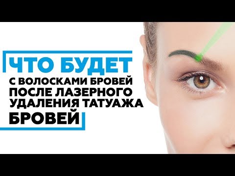 Удаление перманентного макияжа (татуажа) ремувером, лазером ...