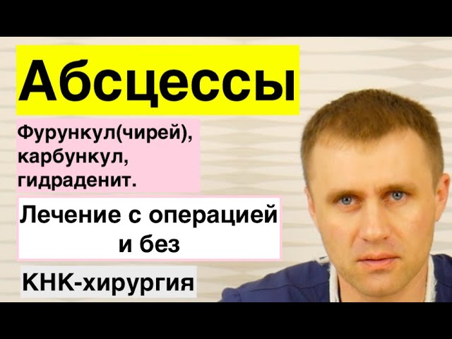 Как лечить фурункул? Причины возникновения, список препаратов ...