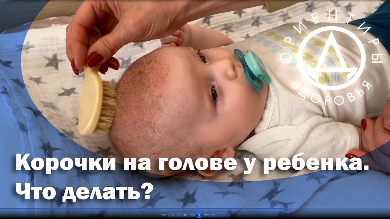 Сыпь у новорожденного — 14 ответов | форум Babyblog