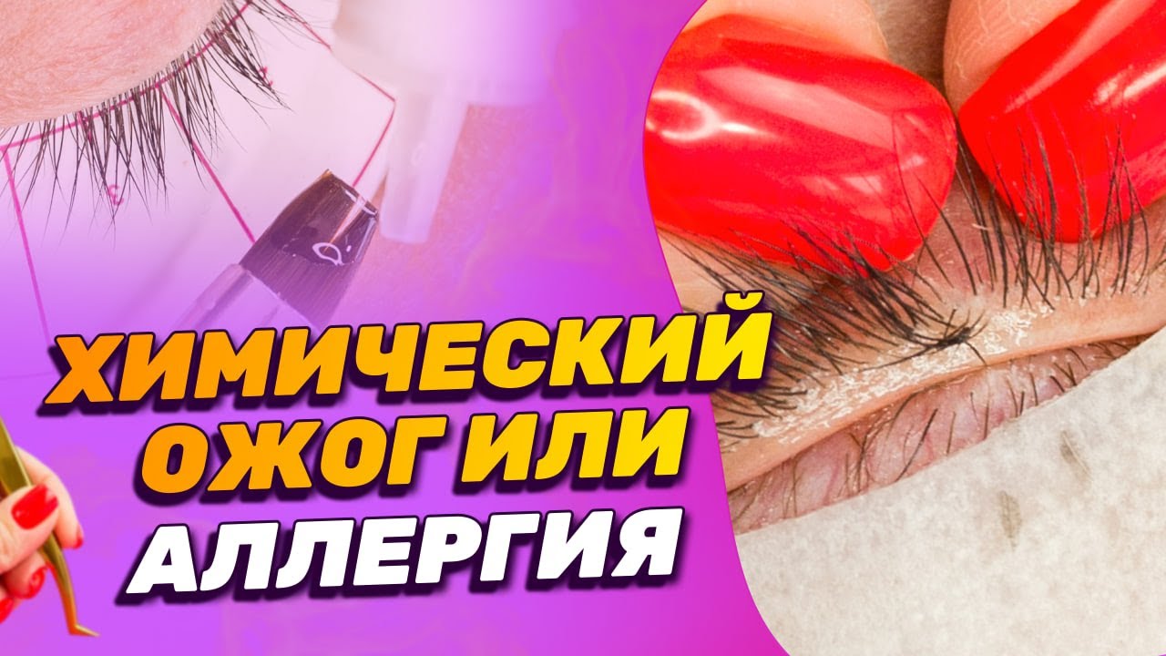 Аллергия и реакция слизистой на испарения клея | Bello Lashes