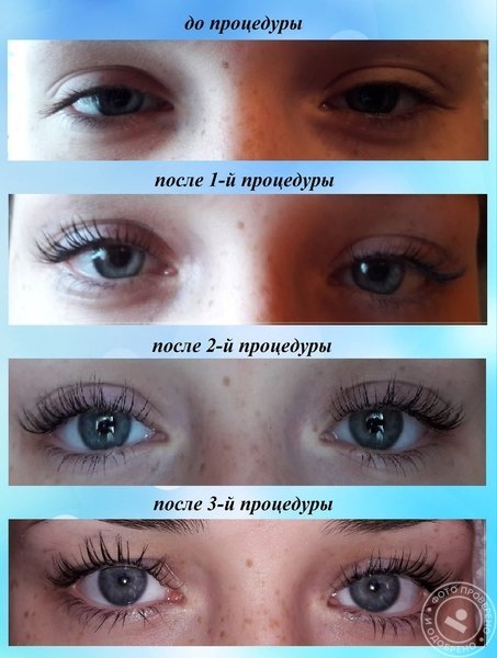 Курс ЛАМИНИРОВАНИЕ РЕСНИЦ, ЗАВИВКА,LASHBOTOX (ID#5001312 ...