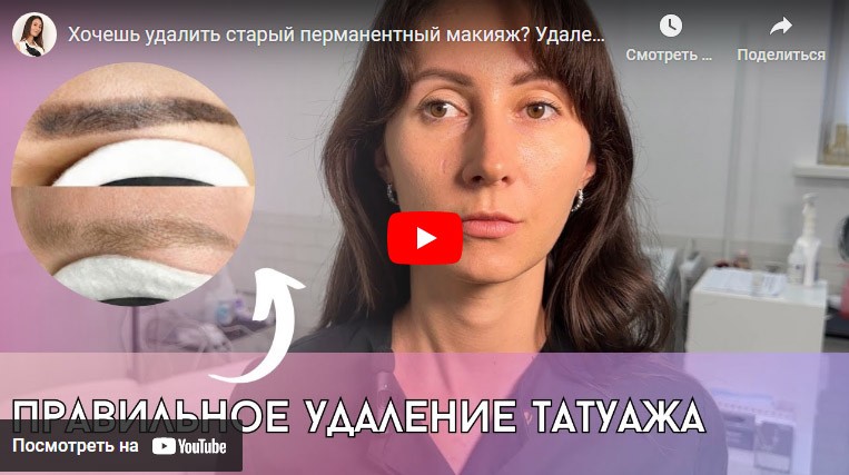 Стоимость услуг удаления татуажа ...