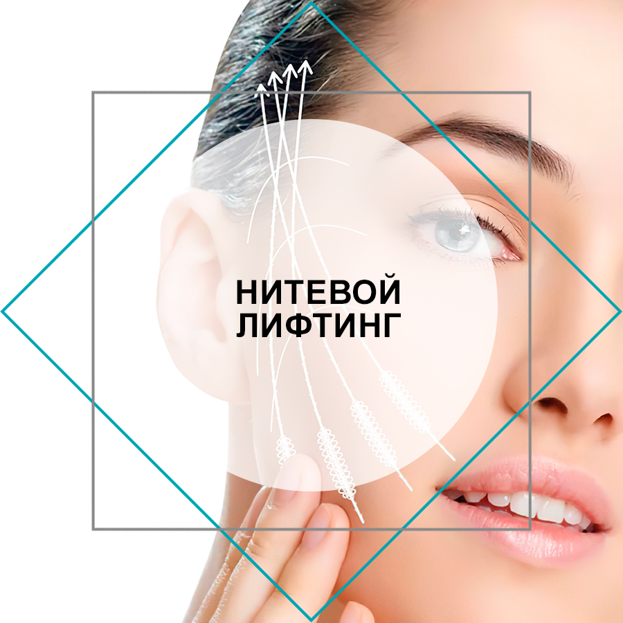 Нитевой лифтинг - фото - VG CLINIC