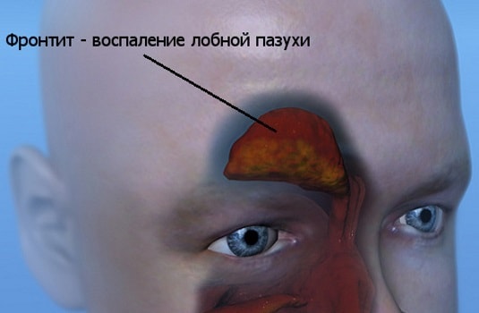 Головная боль: средства и методы облегчения головной боли ...