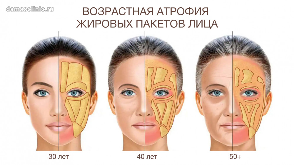 Воспаление придаточных пазух носа: описание, симптомы и лечение