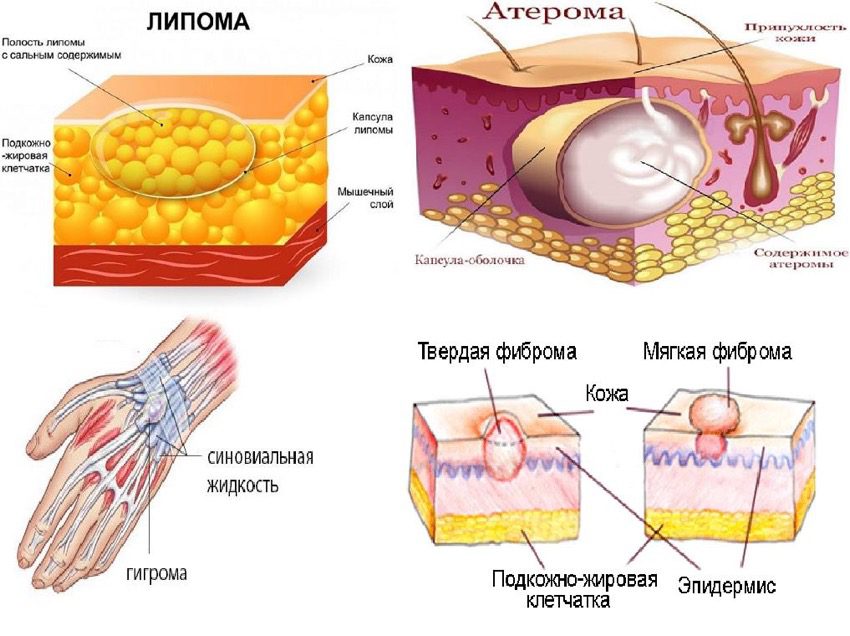 Косметолог / ресницы / брови Рязань | 🧐Атерома - народное ...