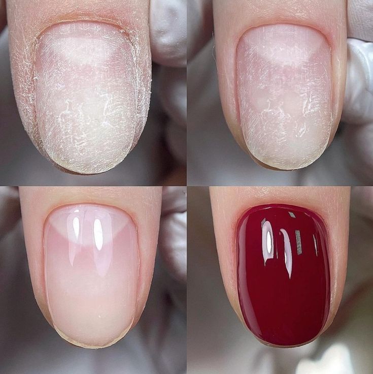 Nails by Chernetsova | Ногти до и после ...