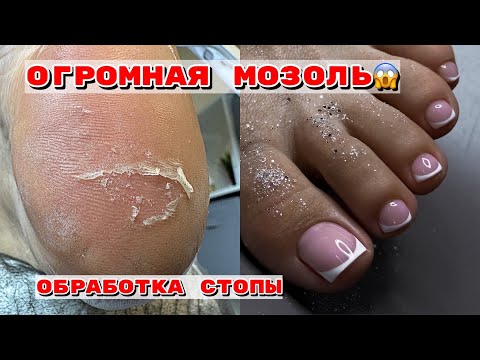 Торцы-плюшки 😭 Топовый корейский дизайн ...