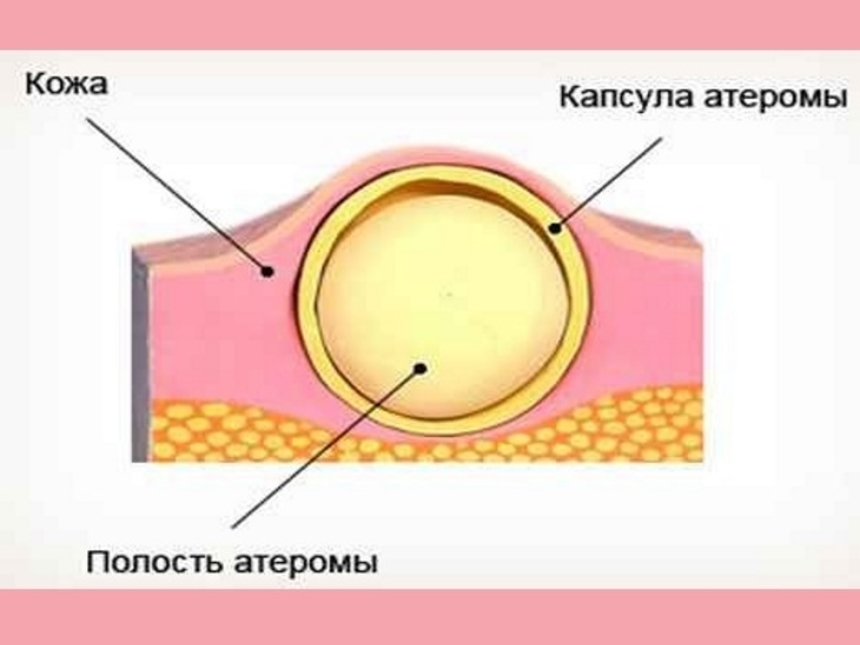 Надбровные дуги — 122 рекомендаций на ...