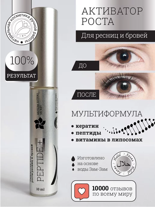 Ботокс ресниц [botox]: что это такое, как делают, сколько ...