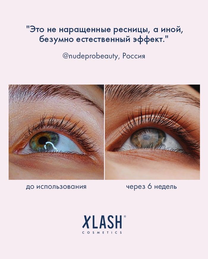 XLASH® — сыворотка для роста ресниц №1 в Европе (@xlashrussia ...