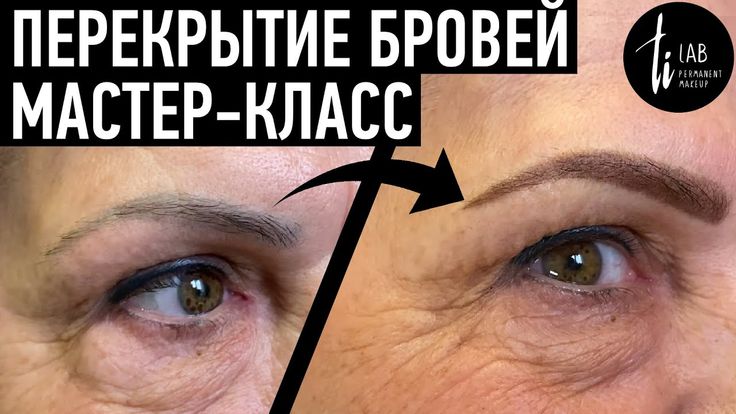 БЕЗОПАСНОЕ УДАЛЕНИЕ ПЕРМАНЕНТНОГО МАКИЯЖА. КАК УДАЛИТЬ ТАТУАЖ ...