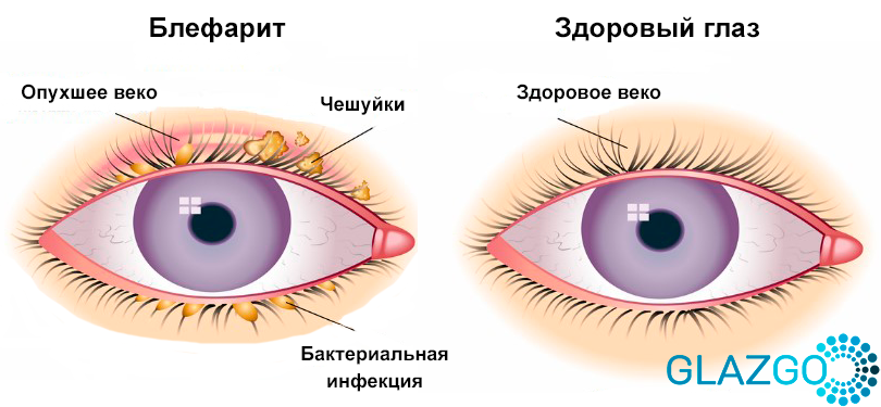 Татуаж Брови Ресницы Людиново - PRO ...