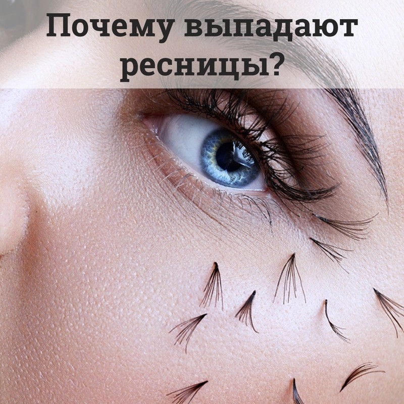 Почему выпадают ресницы: причины и что делать | THE LASHES