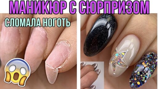 ГИПЕРГИДРОЗ 🥺 Как с этим работать ...