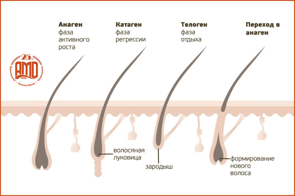 Почему после мытья выпадают волосы? | Блог IHC Clinic