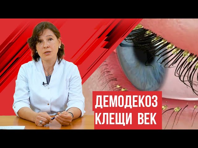 Демодекоз на лице: причины и методы лечения - Coolaser Clinic